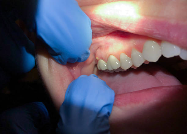 Best After-Hours Emergency Dentist in Forest Glen, MD