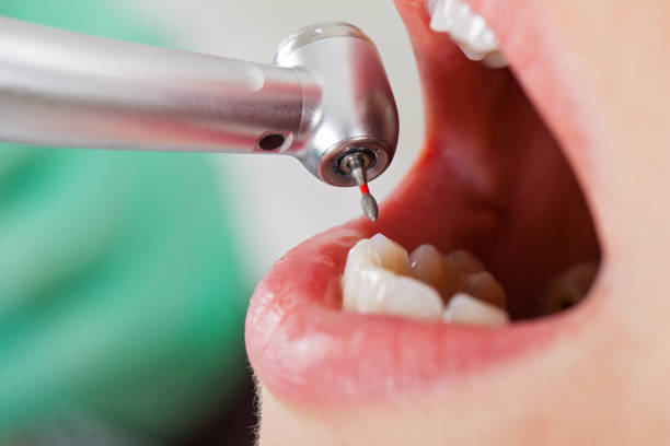 Best Emergency Orthodontic Repairs in Forest Glen, MD